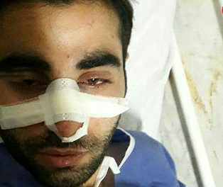 کتک زدن وحشیانه پرستار در بیمارستان امام خمینی+عکس