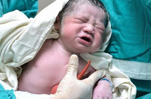 زایمان طبیعی در بیمارستانهای دولتی رایگان است