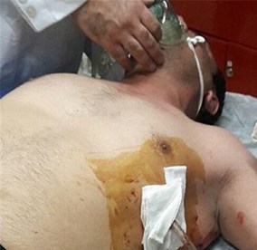 حمله مسلحانه دو مامور شهرداری در حین انجام وظیفه به دست عوامل مالکان یک بنای غیرمجاز 