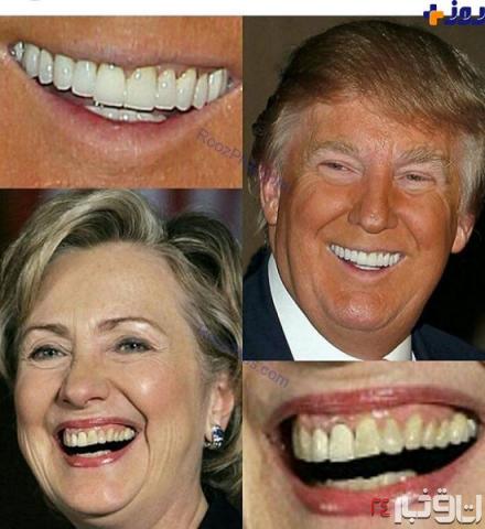 مقايسه جالب شكل دندانهاي هيلاري و ترامپ+عکس