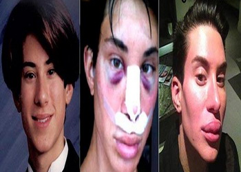  در کلینیک‌های زیبایی مردانه چه می گذرد؟
