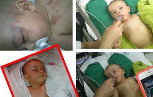 جزییات تازه از شکنجه یک نوزاد توسط پدر معتاد در رشت