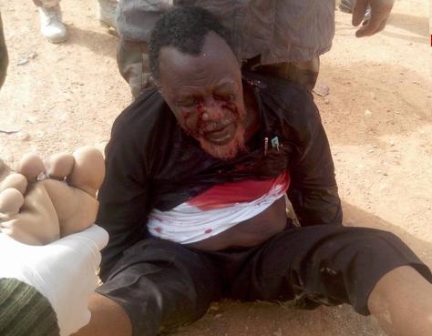 جزئیاتی محرمانه از علت آزادی شیخ زکزاکی/ چه داروی مرگ آوری به رهبر شیعیان نیجریه تزریق شده؟