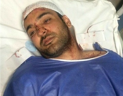 حادثه دلخراش برای فرشید فارسی‌نژادیان ملی پوش دوچرخه سواری ایران در کرمان 