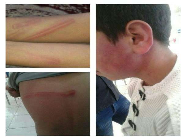 تنبیه بی رحمانه دانش آموزان در قاین+تصاویر