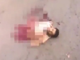  فیلم(18+) یک داعشی، با وجود دو نیم شدن بدن زنده ماند!