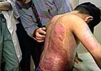 بازهم بخاری نفتی در روستای چارقلی شهرستان ترکمن حادثه آفرید