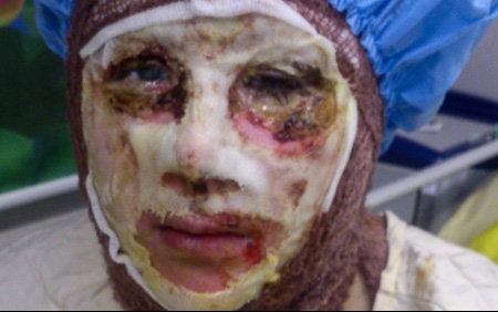 ارتباط اسيدپاشان با سرويس‌هاي اطلاعاتي