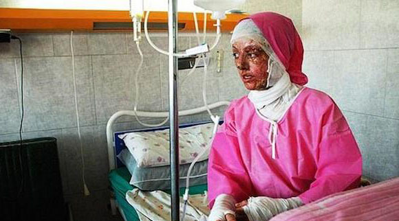 این حرکت به اندازه اسیدپاشی غیراخلاقی و غیرانسانی نیست؟