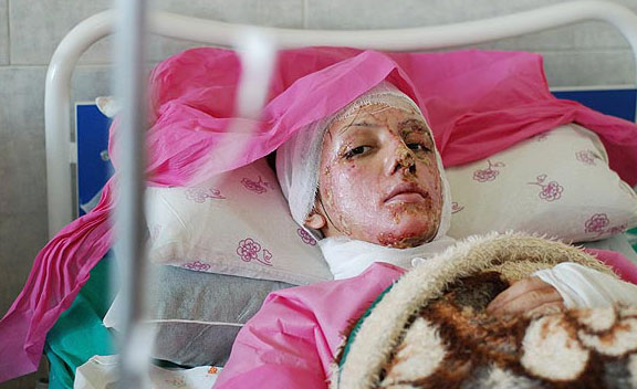 پایگاه ،عدالت خواهان ،حق طلبان ،عدالت طلبان ،سیاست ،سیاسی ،روحانی ،رئیس جمهور ،اصفهان ،ماجراي ، ،خرین خبر ،اسيدپاشي ،به زنان ،به دختران ، آخرین تحولات در مورد پرونده،اسید پاشی در مشهد و تهران ،اسید پاشی ،پاشیدن آب به صورت زنان