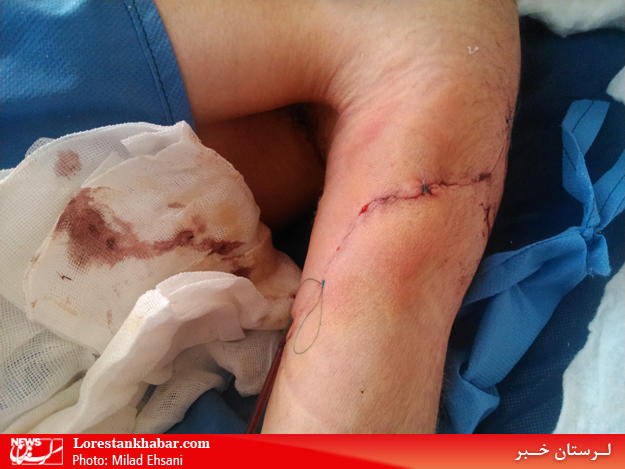 عدالت خواهان گلستان ،سیاست ،حمله ،به طلبه ،لرستانی ، آمر به معروف ،اسید پاشی ، امر به معروف ،حمله ،مجروح ،کتککاری ،اراذل به ،تذکر لسانی ،حجت الاسلام میرزایی ،طلبه ،لزستانی ،طلبه امر به معروف لرستانی ،سرهنگ پازدار ،ستاد احیای امر به معروف و نهی از منکر ،سربازان نظام و انقلاب