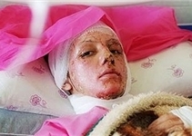 آیا اسیدپاشی افساد فیالارض است؟