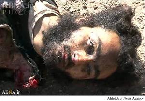 جسد دو داعشی پس از عملیات انتحاری+تصاویر(۱۸+)