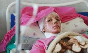 آخرین خبر از وضعیت جسمانی قربانی اسیدپاشی