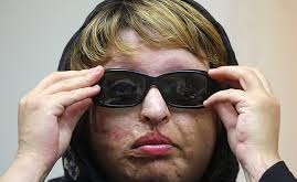 برادر آمنه بهرامی، قربانی اسیدپاشی خودکشی کرد