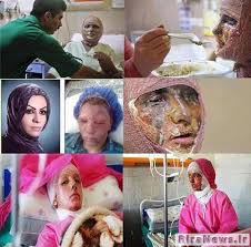 کشف سرنخهایی در زمینه اسید پاشی اصفهان