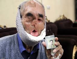 پیگیری یک مصوبه در مورد جانبازان