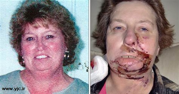 اتفاق آتش سوزی حین جراحی / عجیب درحین عمل جراحی+تصاویر 