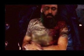 ابوبکر البغدادی سرکرده داعش برای درمان به اسرائیل منتقل شد