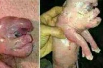 این بچه خوک نوزاد زن داعشی نیست/تصاویر