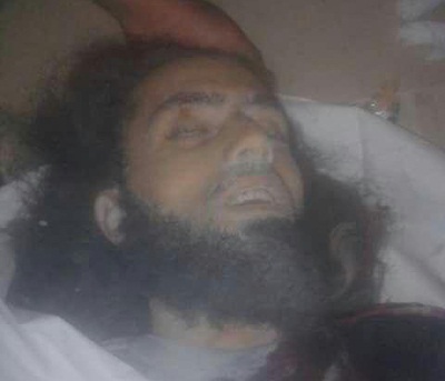 هلاکت «محمد سرحان» ملقب به «الجراح» فرمانده نظامی گروه تکفیری جبهة النصرة + عکس 