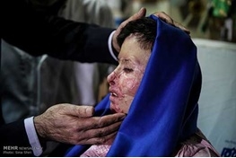 بازخوانی قربانی اسیدپاشی ( سهیلا جورکش) اصفهان از روز حادثه/ آرزو دارم اسیدپاش را ببینم