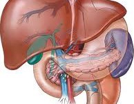 درمانی سنتی برای رهایی از کبد چرب