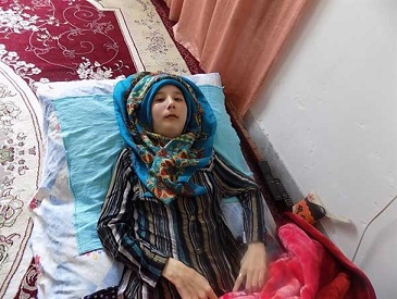 دختر گمیشانی که به مرور همه بدنش استخوان می شود+تصاویر