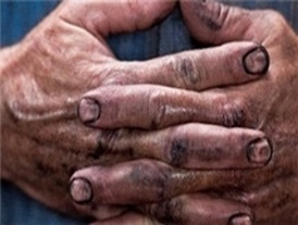   آیا انصافا دولتمردان ما وافعا یک شب گرسنه خوابیده‌اند؟